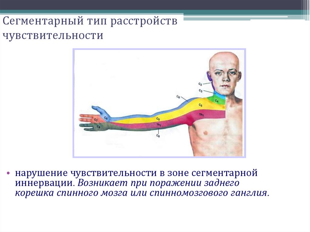 Синдромы нарушения чувствительности. Периферический корешковый Тип. Сегментарный Тип нарушения чувствительности неврология. Сегментарно-корешковый Тип расстройства. Нарушение чувствительности схема.