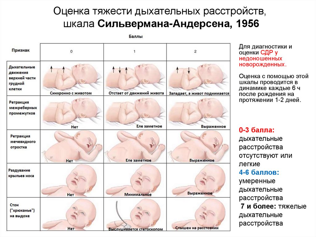 Грудное кормление новорожденного норма. Прикладывание к груди новорожденного недоношенного. Этапы грудного вскармливания недоношенных детей. Основные критерии для прикладывания к груди недоношенного ребенка.