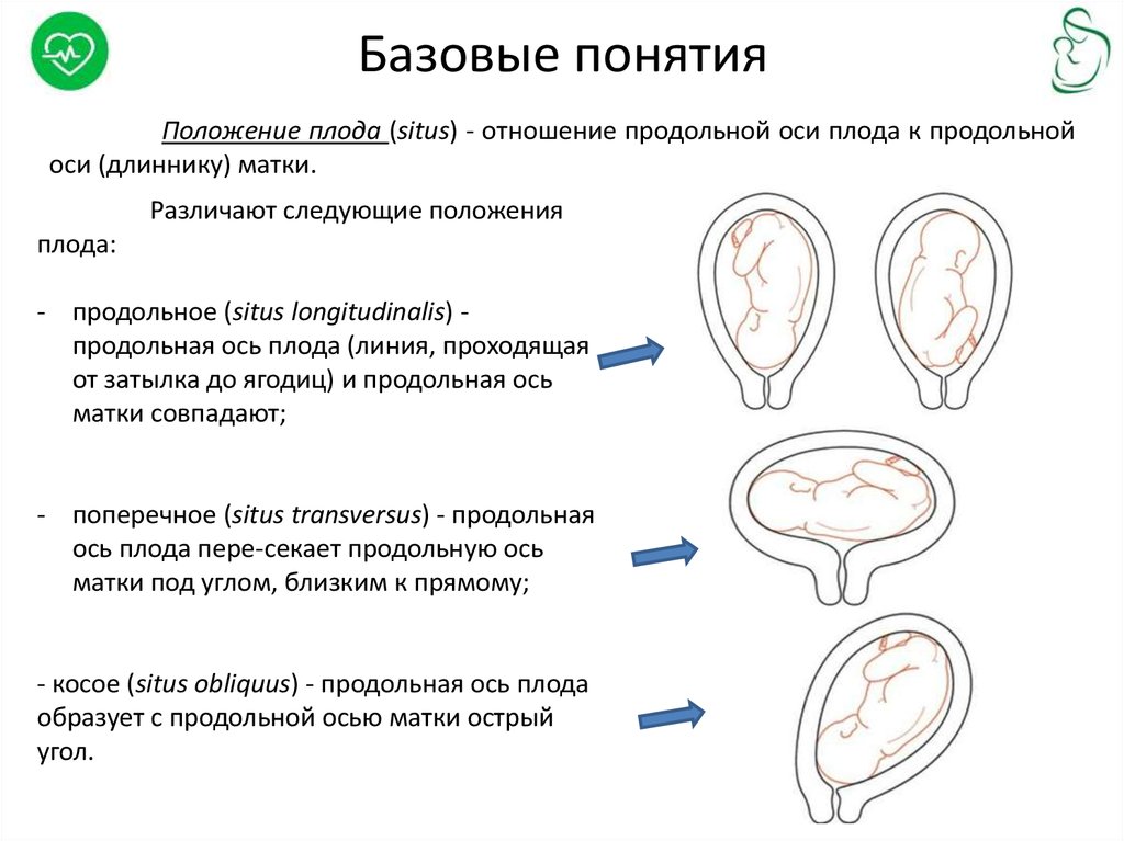 39 недель положение плода