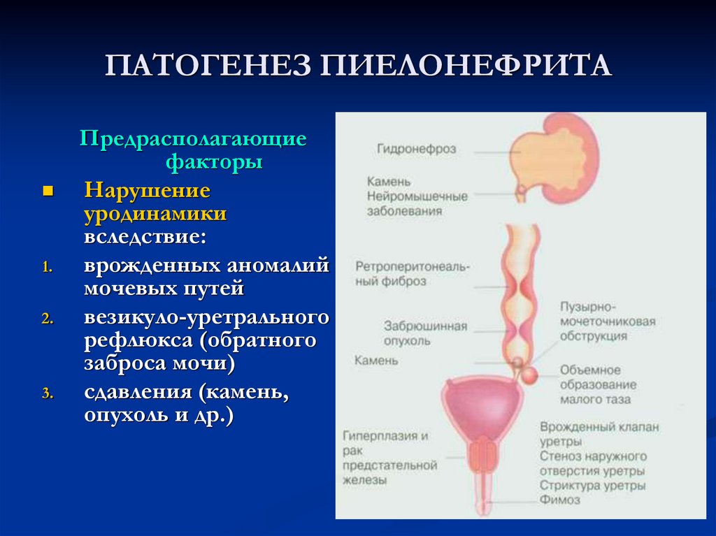 Схема лечения почек и мочевого пузыря у женщин