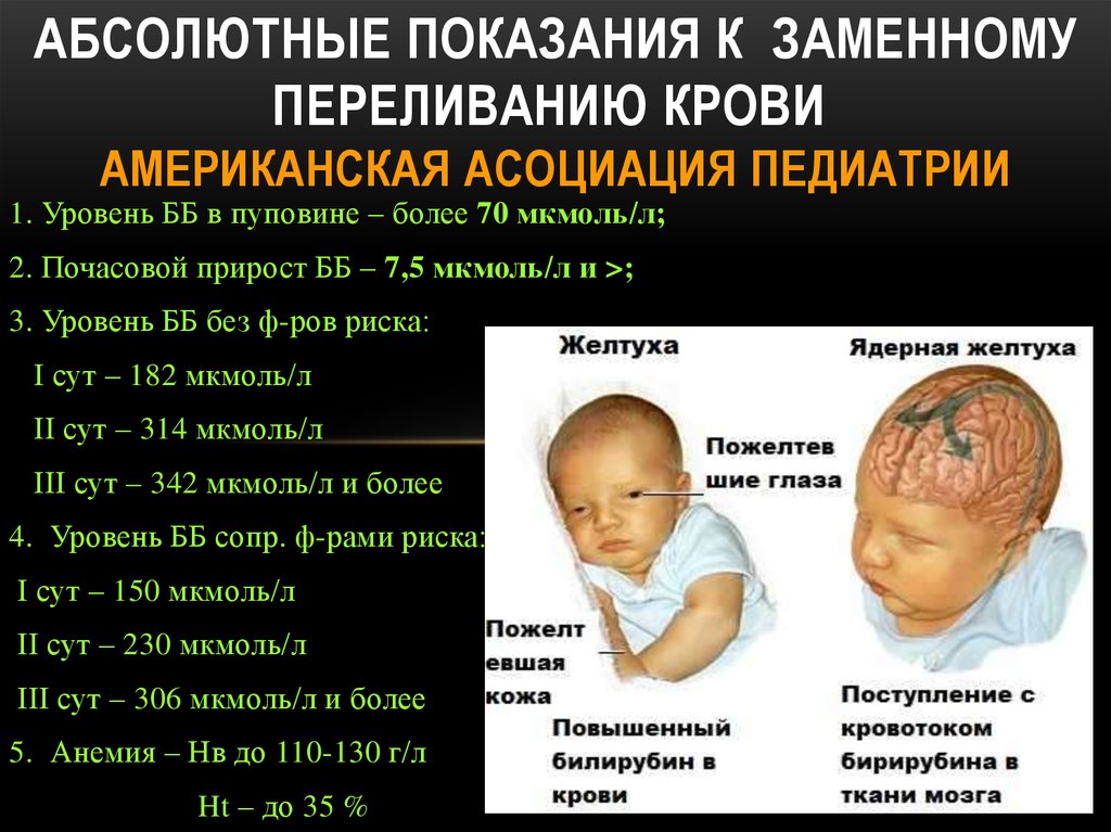 Ребенок желтуха почему. Гемолитическая желтуха новорожденных. Гемолитическая болезнь новорожденных. Гемолитические заболевания новорожденных.