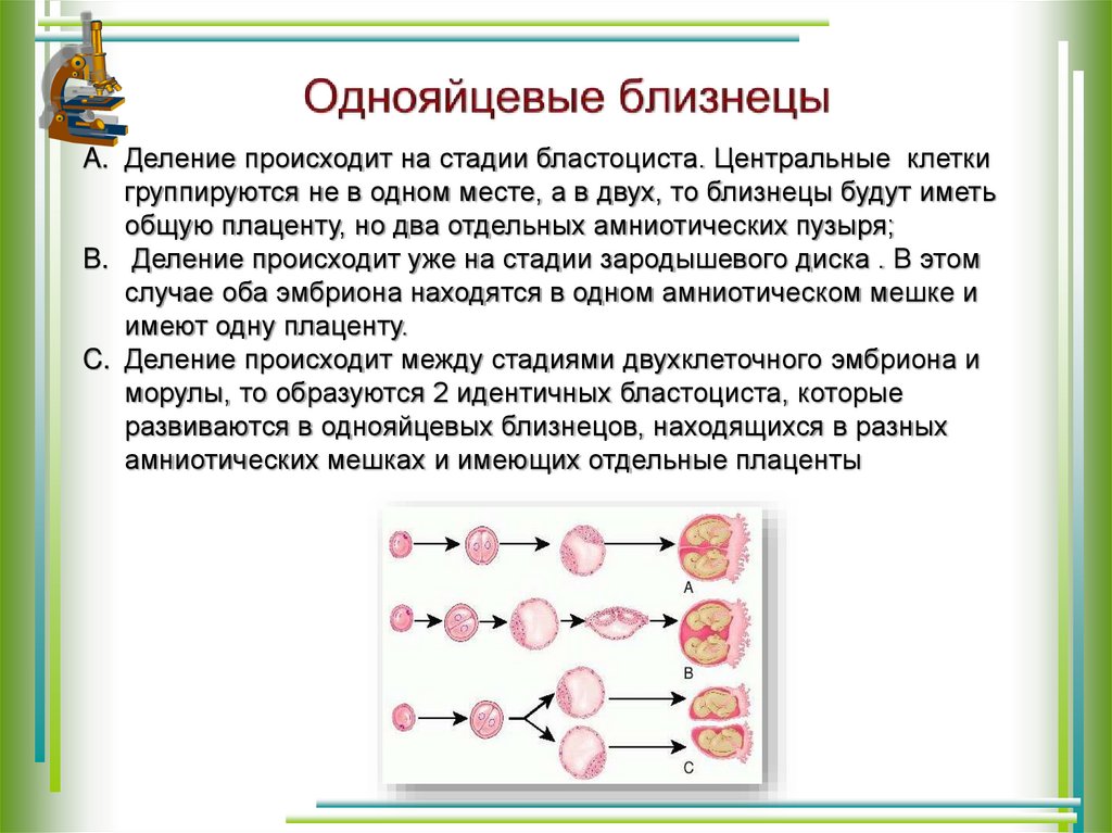 Однояйцевые близнецы презентация