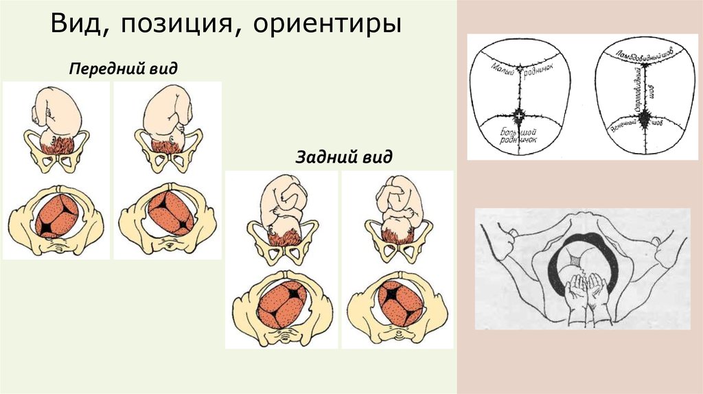 Вид позиции