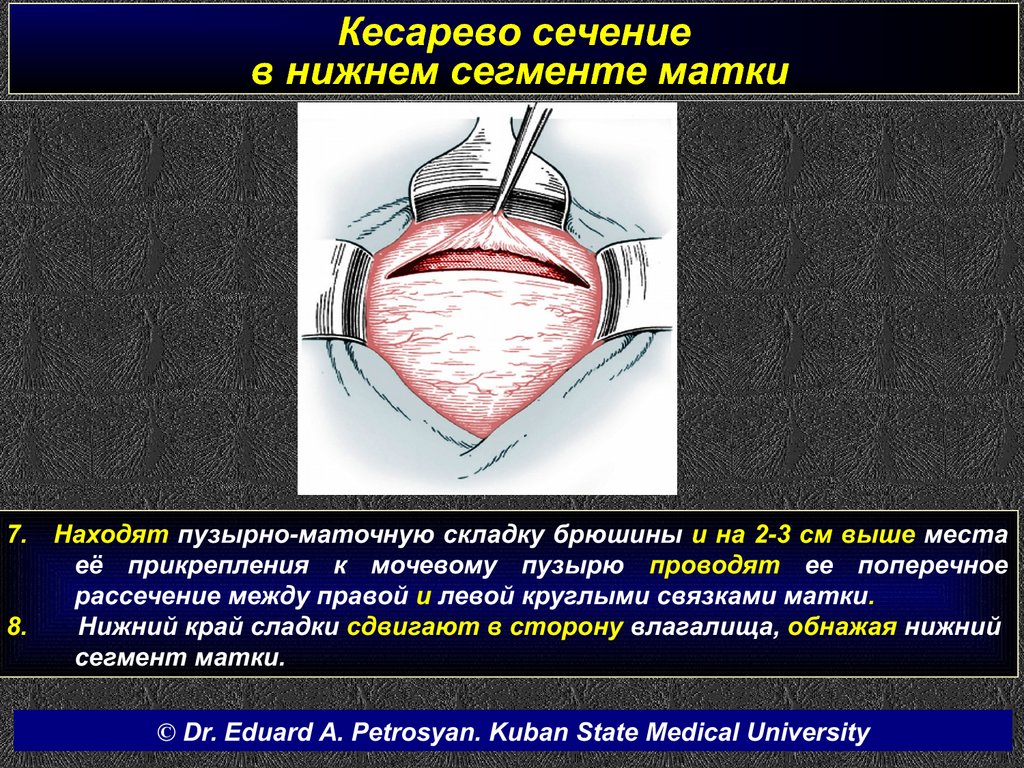 Кесарево сечение коровы презентация