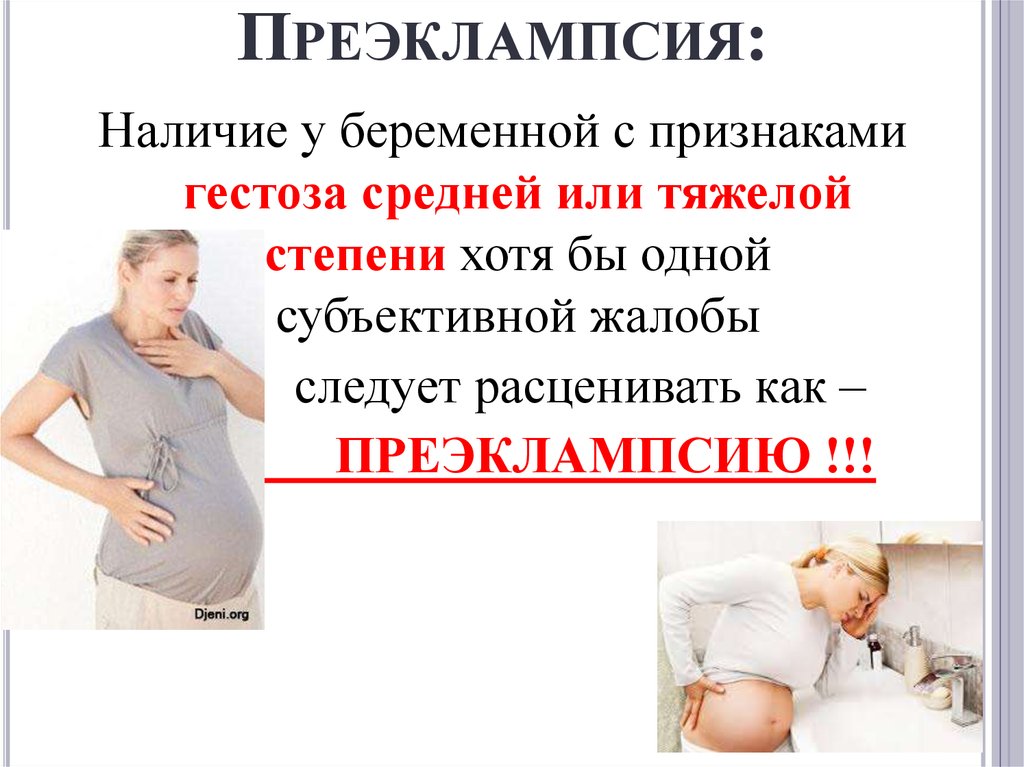 Насколько опасна беременность. Преэклампсия беременных. Симптомы преэклампсии у беременных. Преэклампсия беременных признаки. Тяжелые гестозы беременных.