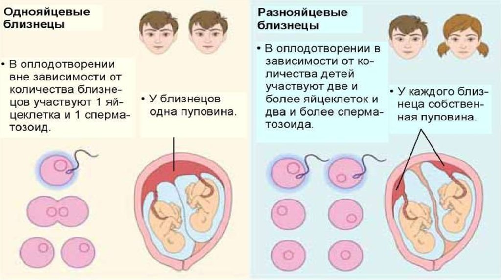 Многоплодная беременность по утвержденным клиническим рекомендациям. Однояйцевые Близнецы и двухяйцевые. Однояйцевые Близнецы оплодотворение. Как получаются двойняшк. Разнояйцовые Близнецы.