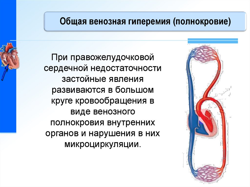 Виды кровообращения. Нарушения органного кровообращения. Венозная дисциркуляция. Венозная дисциркуляция симптомы. Микроциркуляция в органах внутренних.