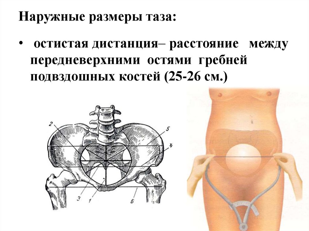 Размеры таза у женщин. Наружные Размеры таза. Измерение размеров малого таза. Наружнре Размеры таза. Что такое наружный и внутренний таз.