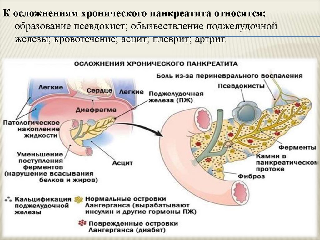 Схема лечения поджелудочной железы