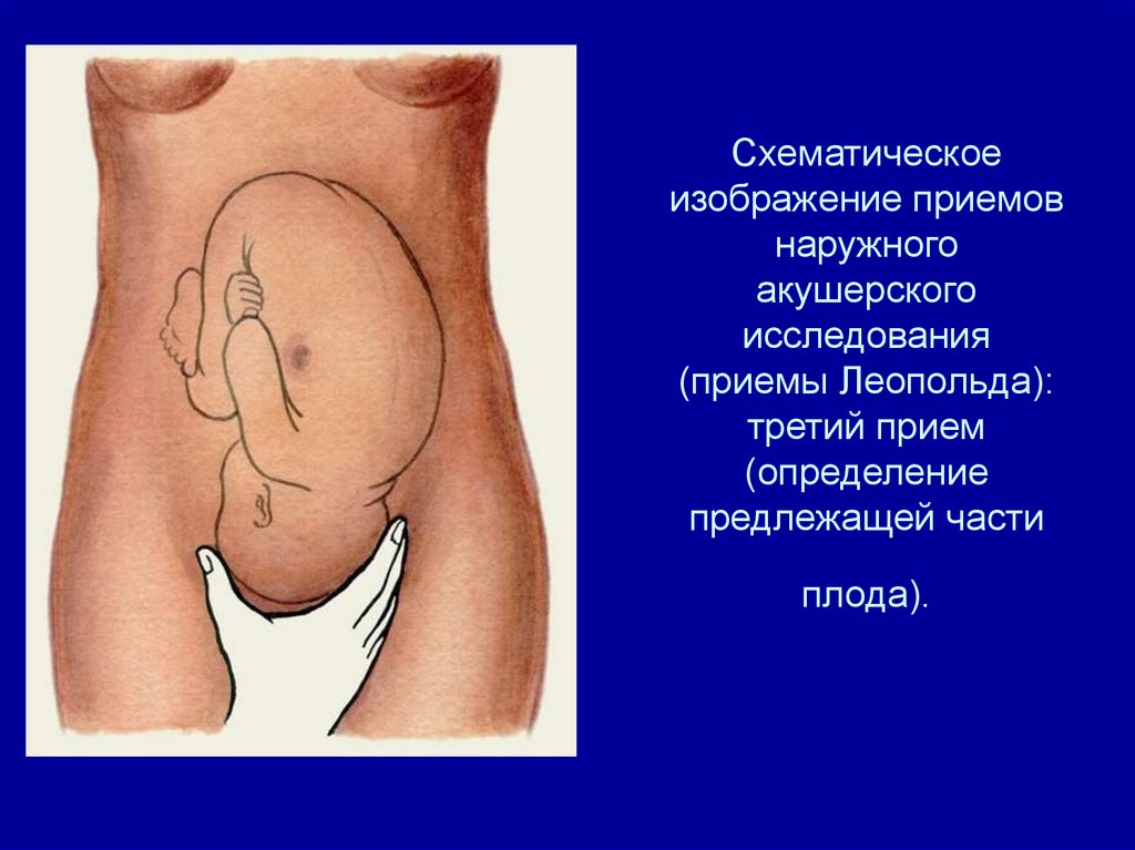 Акушерское исследование