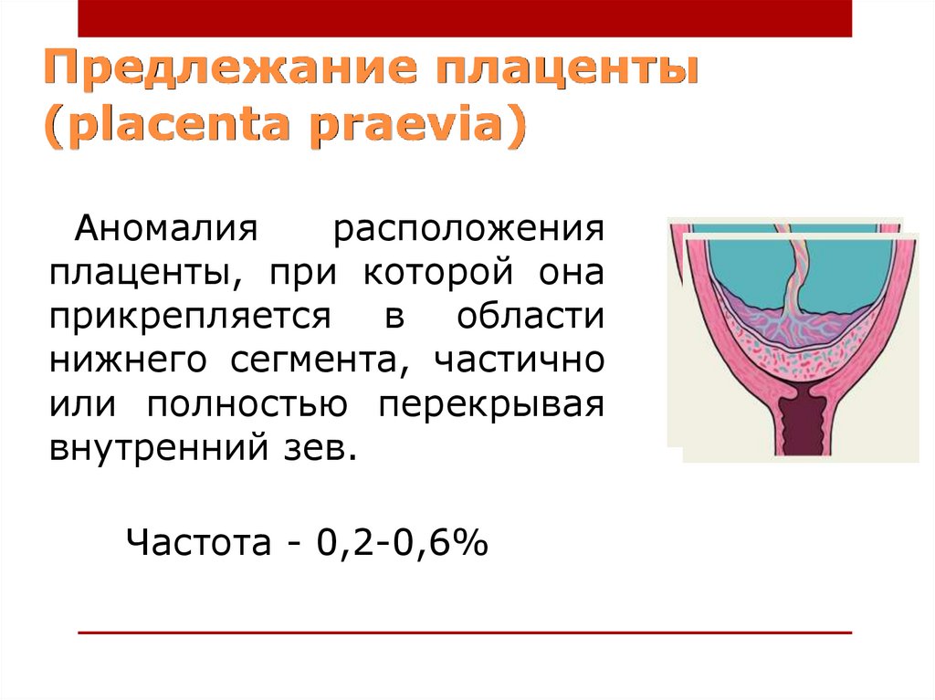 Небольшая отслойка плаценты на ранних сроках