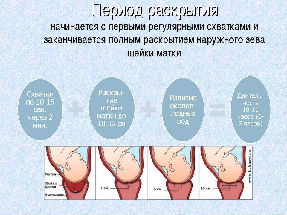 Как понять что начались. Схватка как понять что началось. Предвестниковые схватки ощущения.