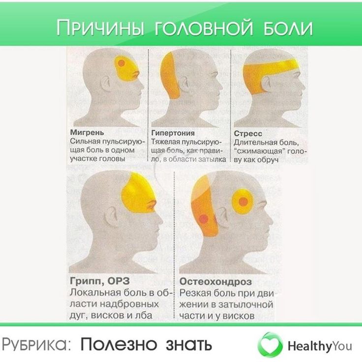 Боли в голове карта