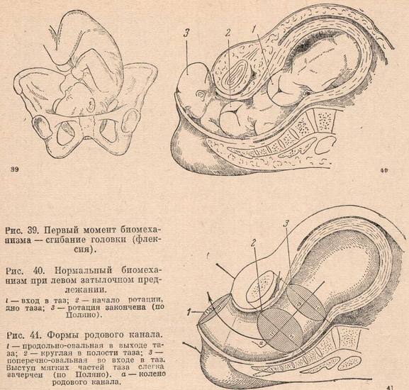 Биомеханизм родов при переднем виде затылочного предлежания презентация