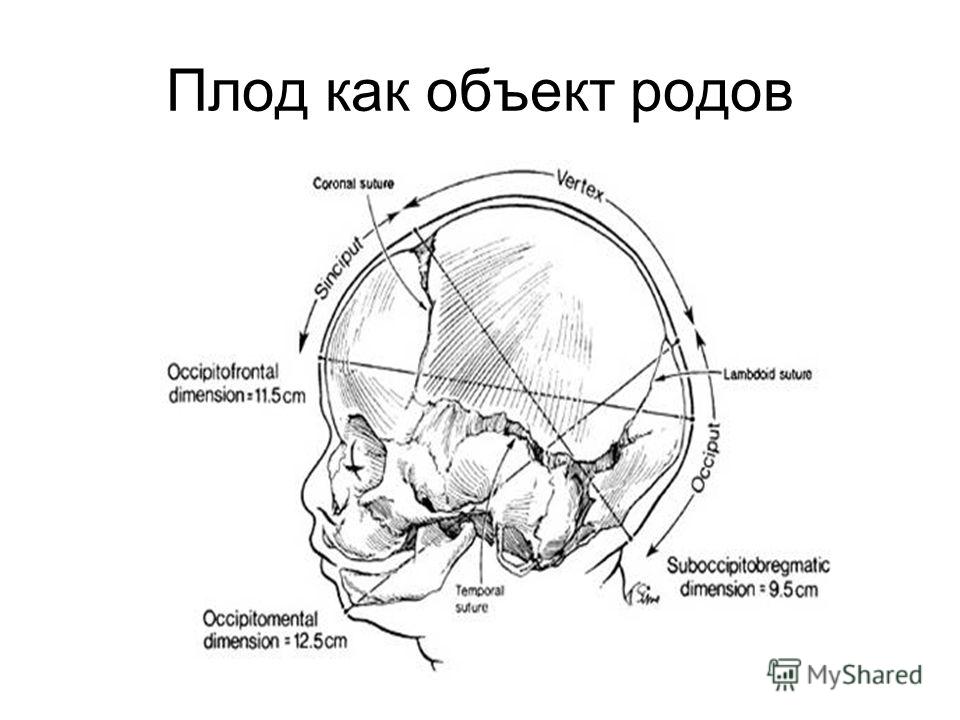 Презентация головка плода