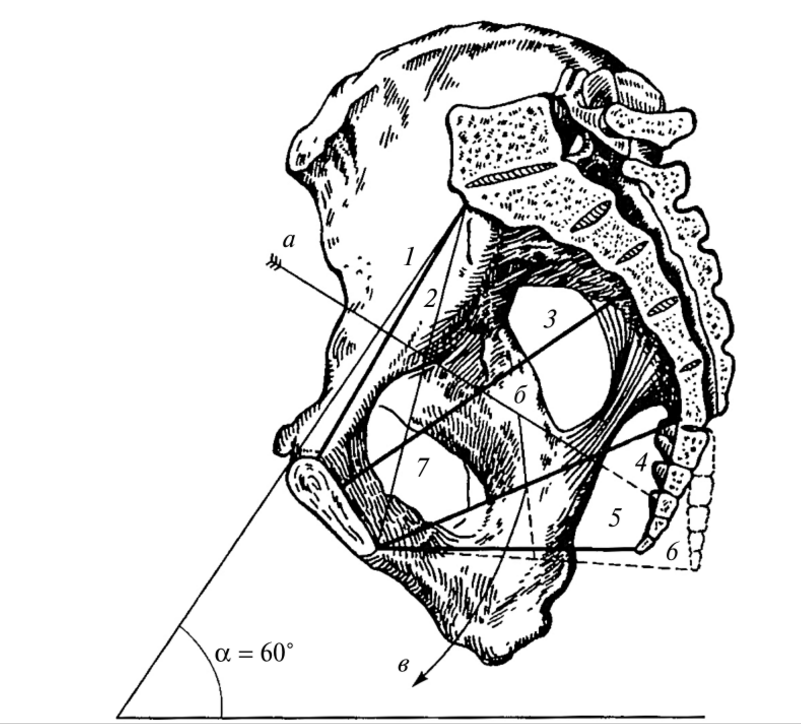 Прямой размер. Анатомическая конъюгата малого таза. Конъюгаты таза анатомия. Анатомическая конъюгата женского таза. Строение таза конъюгаты.