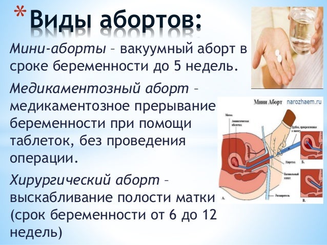 Сделать платное. Во сколько можно делать аборт. Сколько стоит сделать аборт. Сколько стоит аборты врачом. Где в Павловской можно платно сделать аборт.