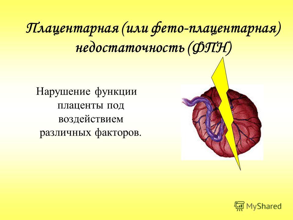 Компенсированная хроническая плацентарная. Плацентарная недостаточность. Хронической фетоплацентарной недостаточности. Первичная и вторичная плацентарная недостаточность.