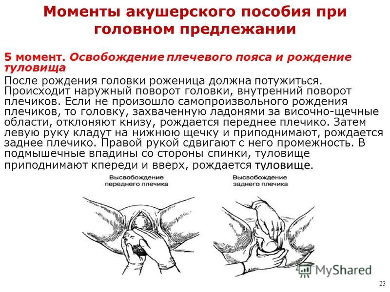 Акушерское пособие. Акушерское пособие при головном предлежании. Ручное акушерское пособие при переднем виде затылочного предлежания. Акушерское пособие при головных предлежаниях («защита промежности»).. Ручное акушерское пособие при головном предлежании.