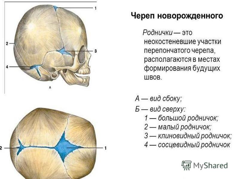 Состояние родничка. Роднички новорожденного анатомия черепа. Форма головы новорожденного Родничок. Строение головы у младенца новорожденного. Строение костей черепа у новорожденного ребенка.