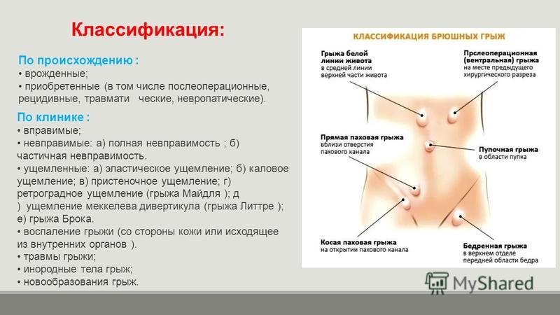 Пупочная грыжа карта вызова скорой медицинской помощи