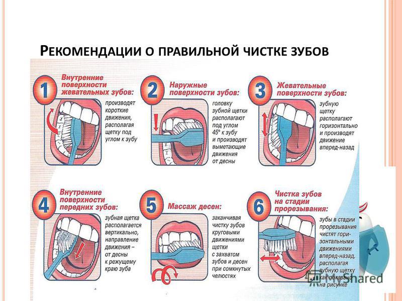 Как чистить зубы. Стандартный метод чистки зубов схема. Алгоритм стандартного метода чистки зубов. Стандартный метод чистки зубов (Пахомов г.н.). Как правильно чистить зубы.