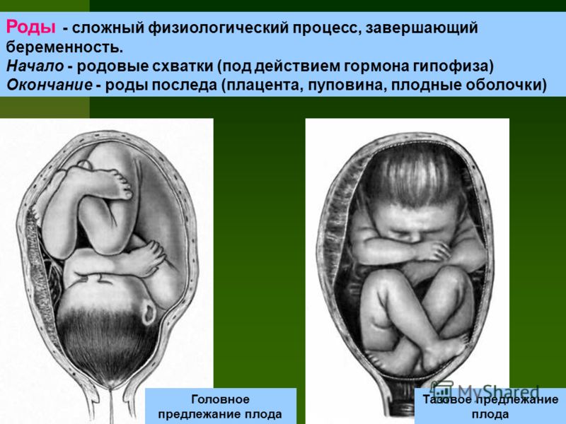 Головное предлежание плода при беременности. Головное и тазовое предлежание. Головное предлежание плода. Тазовое предлежание плода.