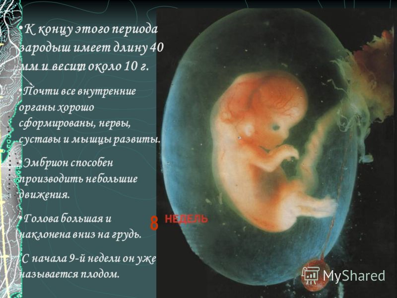 Беременность 9 неделя отзывы. Зародыш человека 9-10 недель. Плод на 8 неделе беременности.