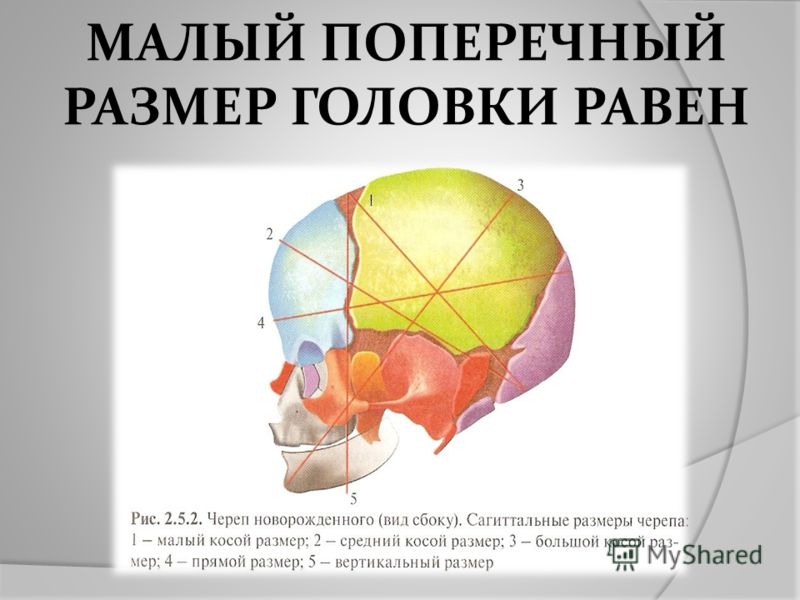 Длина головы новорожденного. Размеры головки плода. Малый косой размер головки плода. Малый поперечный размер головки. Малый косой размер головки.