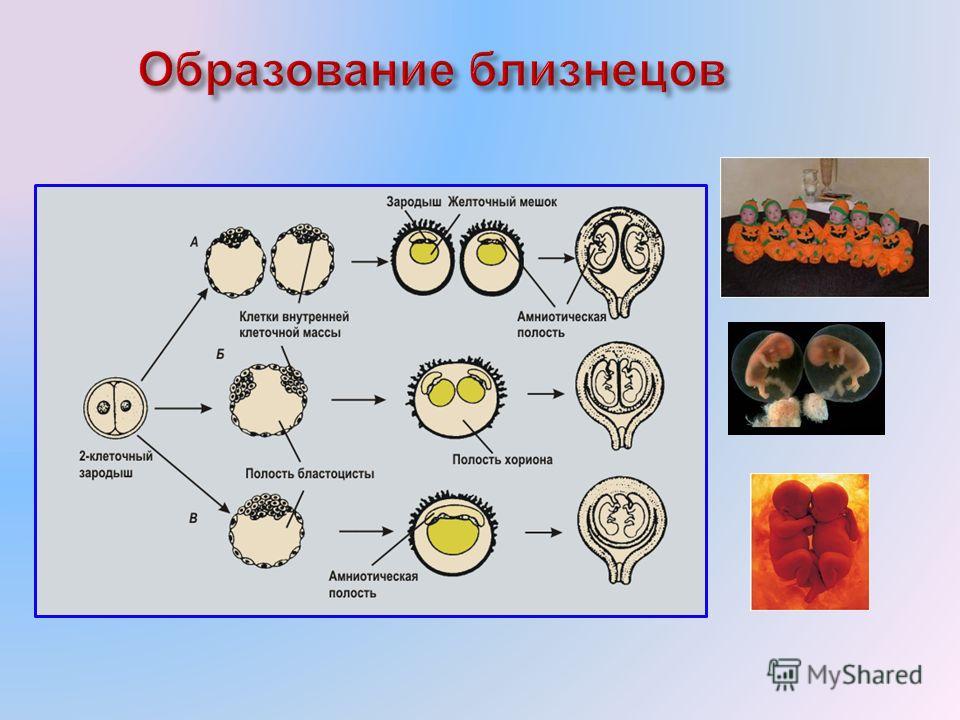 Виды близнецов схема