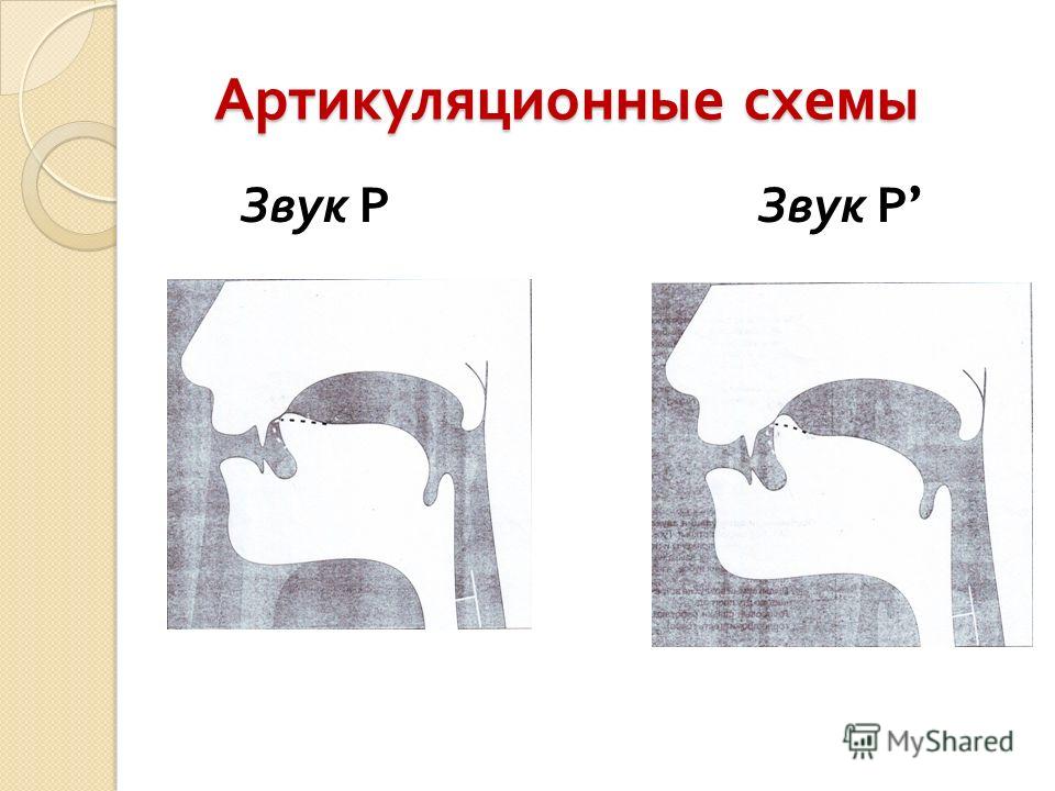 Артикуляционные профили звуков в картинках