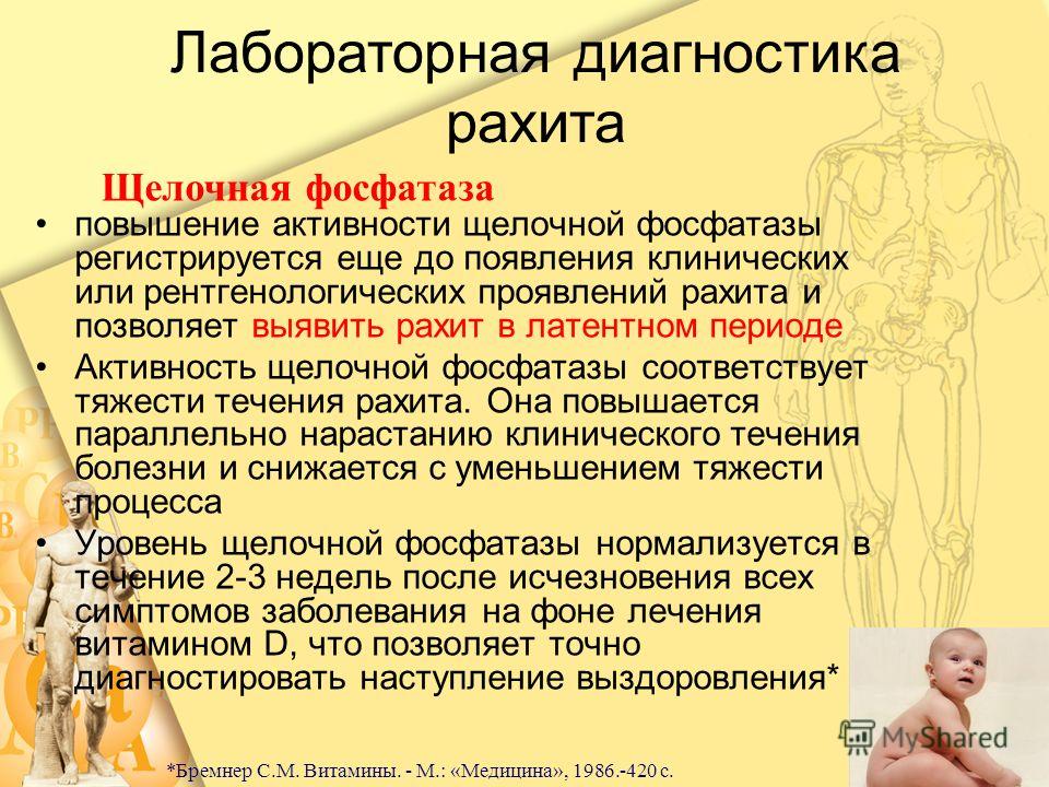 Клиническая картина рахита