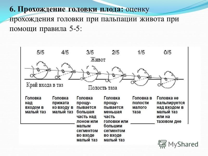 Презентация головка плода