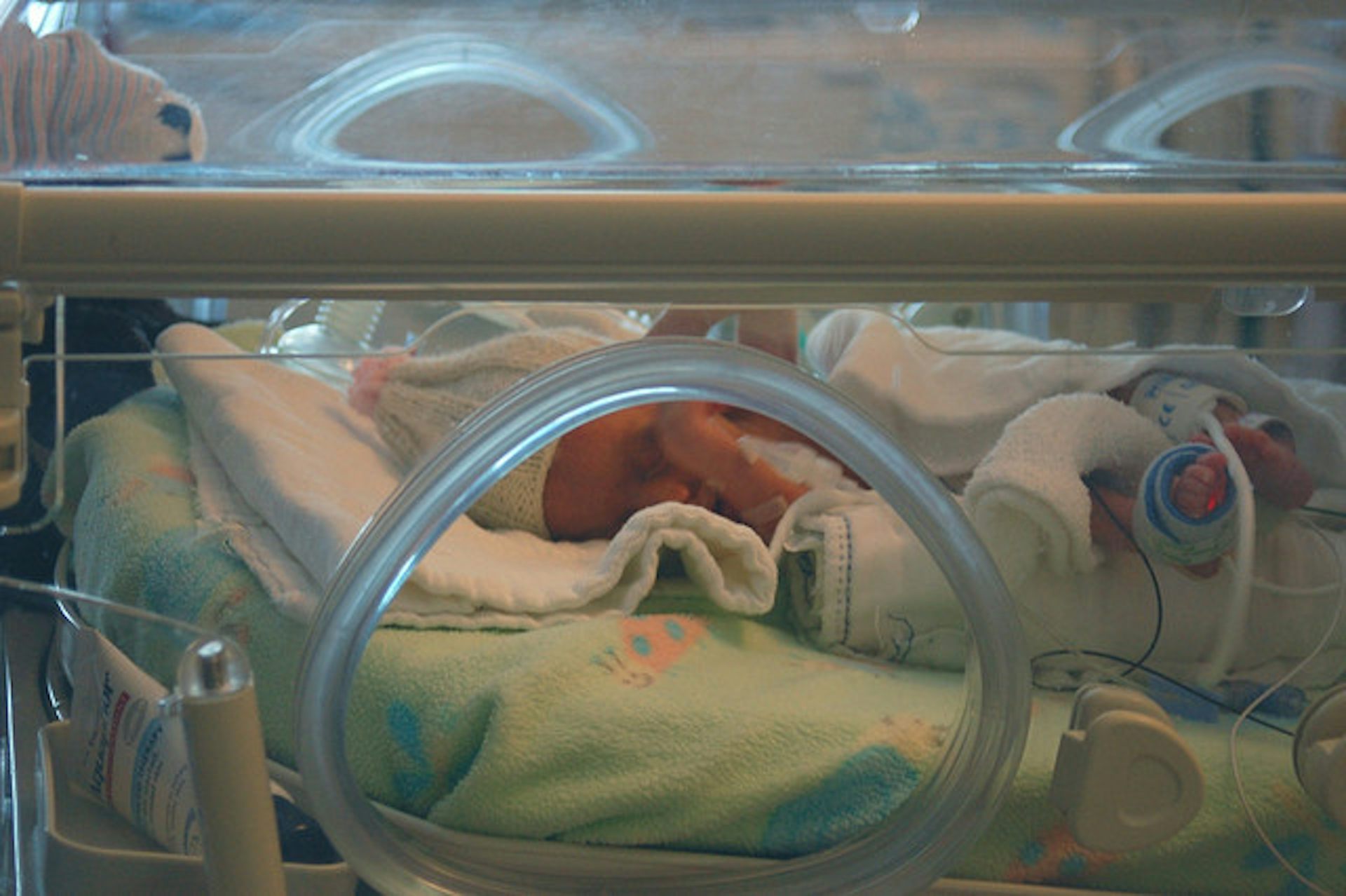Раньше времени родилась. Недоношенные дети в роддоме. Недоношенный новорожденный. Недоношенный ребёнок в инкубаторе.