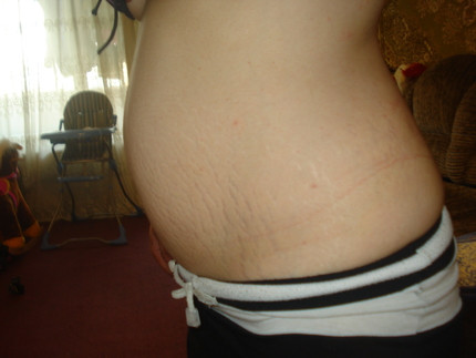 Беременный живот. 10 акушерская неделя беременности живот. Живот на 9-10 неделе беременности. Живот беременной на 10 неделе. Живот на 9 неделе беременности.