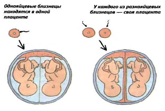 Как появляются близнецы