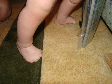 Опора на носочки. Малыш поджимает пальчики на ногах. Ребенок поджимает пальцы на ногах. Ребенок подгибает пальцы на ногах.