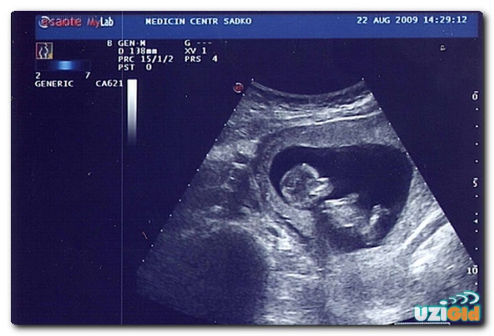 12 недель беременности что происходит с малышом и мамой фото
