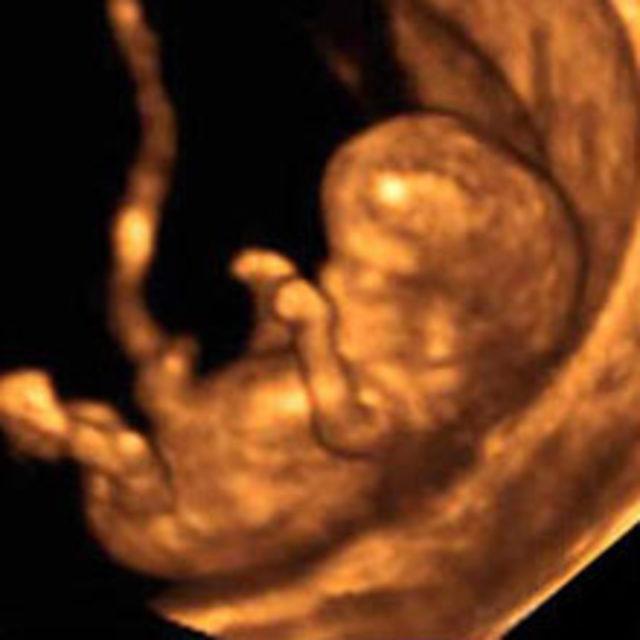 Как выглядит ребенок на 12 неделе беременности фото