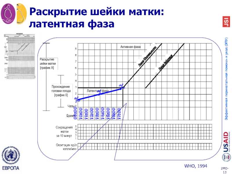 Партограмма в акушерстве как заполнять образец заполнения