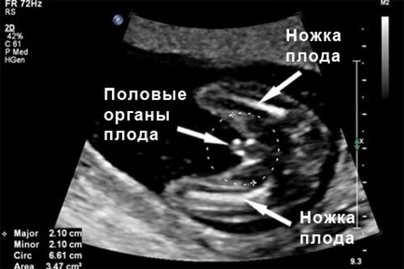 17 неделя беременности отзывы. УЗИ на 16-17 неделе беременности пол ребенка. УЗИ на 17 неделе беременности пол ребенка. УЗИ В 12 недель беременности пол ребенка. УЗИ на 17 неделе беременности пол.