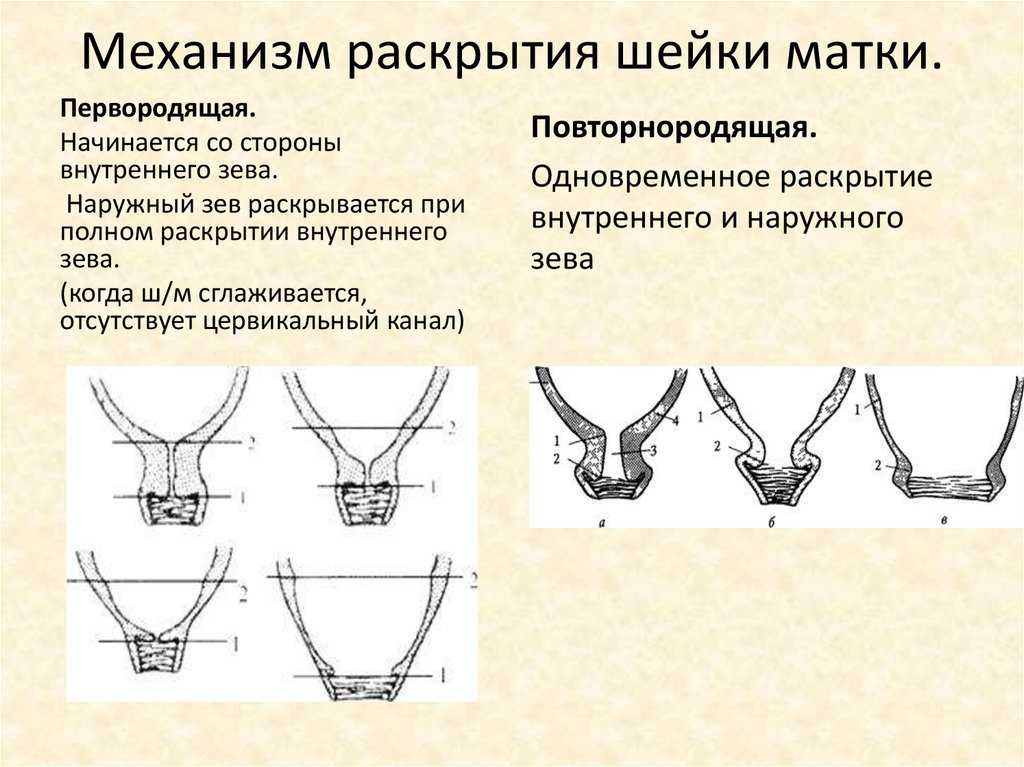 Где находится шейка матки картинка