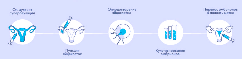 Помощь оплодотворении. Этапы экстракорпоральное оплодотворение. Экстракорпоральное оплодотворение схема. Этапы экстракорпорального оплодотворения. Искусственное оплодотворение схема.