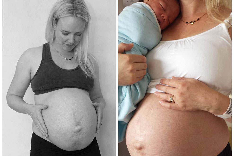 37 недель рождение. Беременность через полгода после родов.
