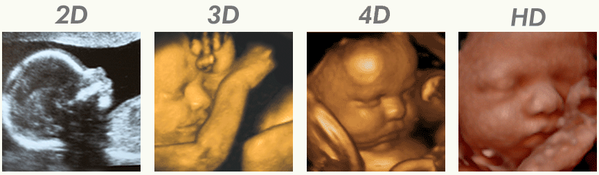 2 скрининг при беременности фото