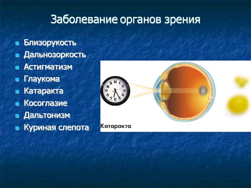 Нарушение функций органов зрения и их профилактика проект