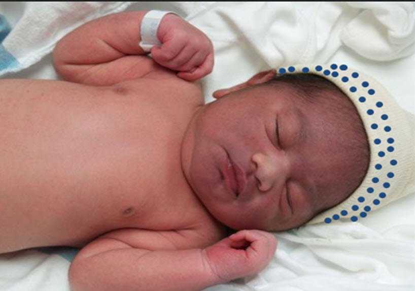 Новорожденный тяжело дышит. Асфиксия новорожденных. Новорожденные с асфиксией. Новорожденные с патологиями. Цианоз носогубного треугольника.