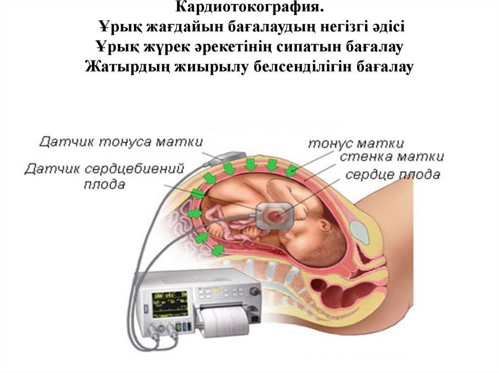 Симптомы тонуса форум