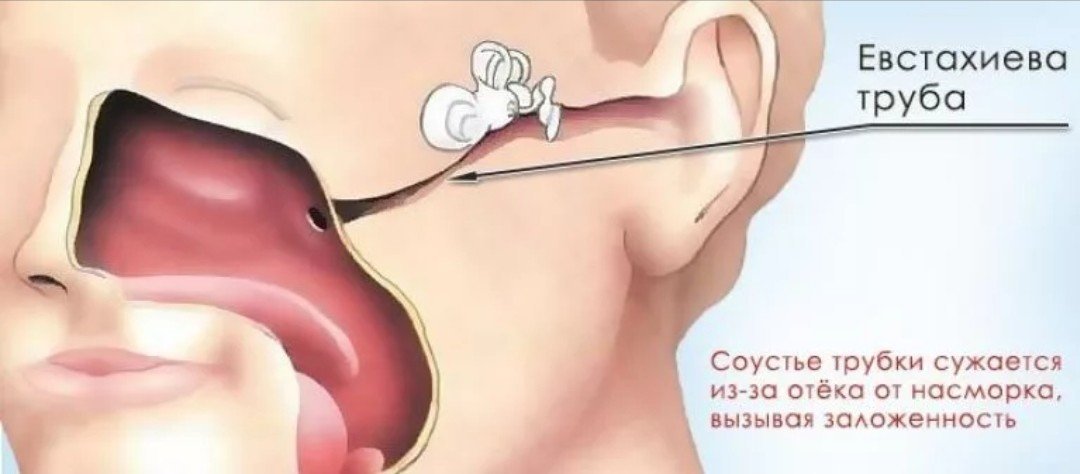 Что делать если болит ухо и горло. Евстахиева (слуховая) труба анатомия. Евстахиева труба и носоглотка.