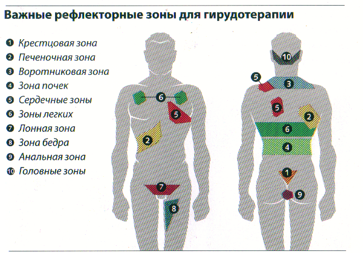 Схемы лечения гирудотерапия